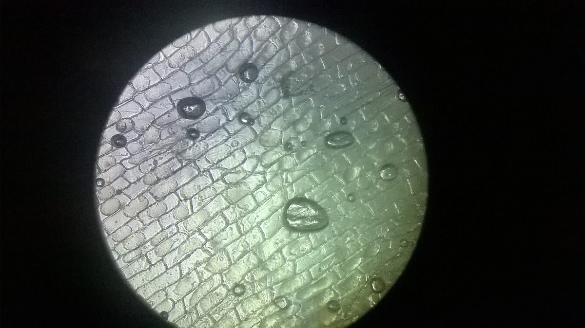A light micrograph of onion peel cells whose contents have pulled back from the walls and are refilling as water re-enters them.