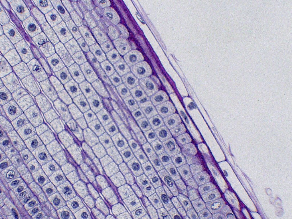 A light micrograph of an onion root tip where many cells are caught mid-division, their chromosomes visible as dark threads.